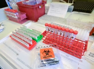 Gales pasó por alto 11.000 casos de coronavirus