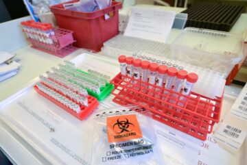 Gales pasó por alto 11.000 casos de coronavirus