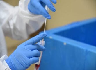 Procesan 10,456 muestras; detectan 1,482 nuevos casos de COVID en las últimas 24 horas