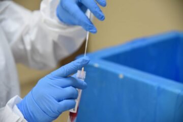 Procesan 10,456 muestras; detectan 1,482 nuevos casos de COVID en las últimas 24 horas