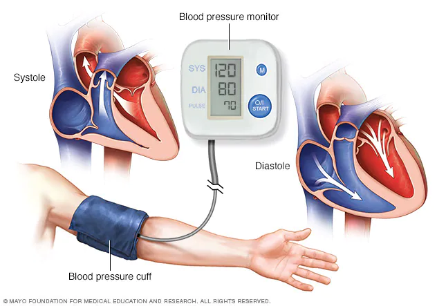 Día Mundial de la Hipertensión: 17 de mayo