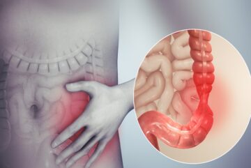 Enfermedad inflamatoria intestinal y síndrome de colon irritable. ¿Son lo mismo?