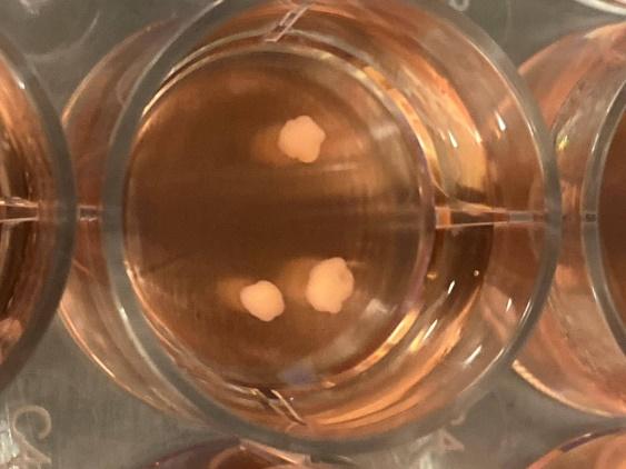 "Pequeños cerebros " creados en laboratorio ayudan a investigar terapias contra la adicción a los analgésicos