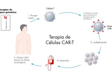 La terapia de células T (CAR-T) da esperanza a pacientes diagnosticados con diversos linfomas