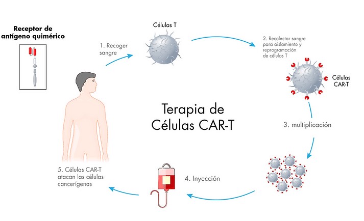 La terapia de células T (CAR-T) da esperanza a pacientes diagnosticados con diversos linfomas