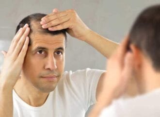 Caída del pelo: causas, síntomas y tratamientos